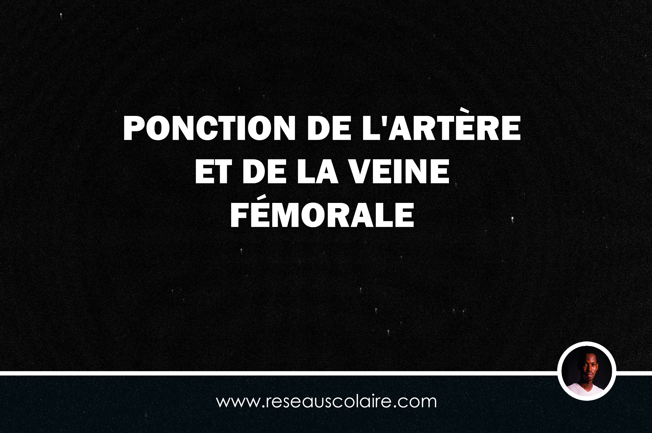 PONCTION DE L'ARTÈRE ET DE LA VEINE FÉMORALE